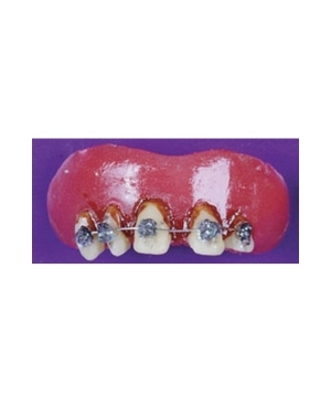 Braces Teeth - Halloween Costume Braces Teeth - Halloween Costume