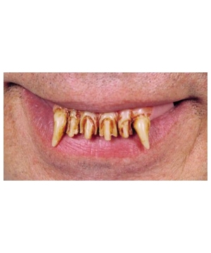 Werewolf Teeth Accessory