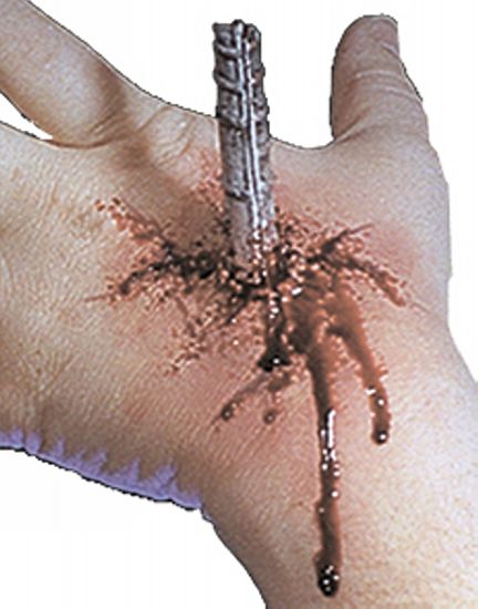 Impaled Kit